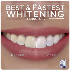 Crest 3D Whitestrips with Light, Teeth Whitening Strip Kit, 20 Strips (10 Count Pack)