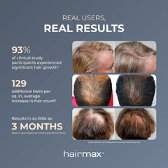 Hairmax Laser Comb For Hair Growth (FDA Cleared), ULTIMA 12 Classic, Laser Hair Growth Treatment for Men & Women