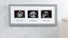 Pearhead Triple Sonogram Pregnancy Keepsake Frame, Watch Baby Grow Through all Three Trimesters - Great Gift For Expecting Parents, Grey