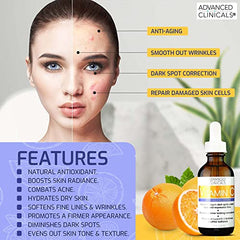 Advanced Clinicals Vitamin C Facial Serum Skin Care Anti-Aging Moisturizer Potent Vitamin C Face Lotion For Dry Skin, Age Spots, Wrinkle Repair, & Uneven Skin Tone, 1.75 Fl Oz (Pack of 1)