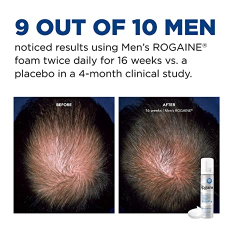 Men's Rogaine 5% Minoxidil Foam for Hair Loss and Hair Regrowth, Topical Treatment for Thinning Hair, 1-Month Supply