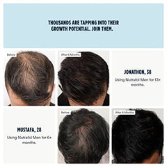 Nutrafol Men Hair Growth Supplement Clinically Effective for Visibly Thicker Hair and Scalp Coverage (1-Month Supply)